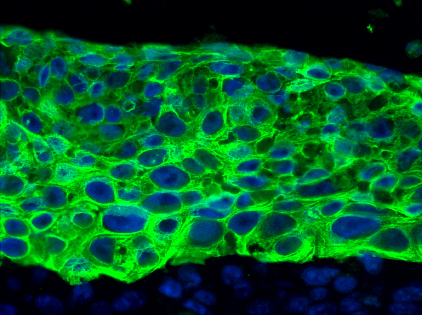 Haut Cytokeratin 14 Färbung in grün, Lothar Koch, Andrea Deiwick